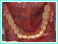 Clinica de implantes de odontologia y estetica.