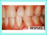 Clinica de implantes y colocacion de dientes.