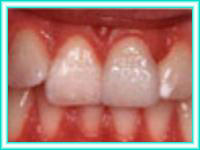 Dental estetica en clinica de odontologia estetica.