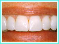 Cursos de estetica dental e implante dental.