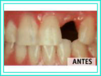 Odontologia estetica en clinica de estetica dental.