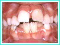 Adultos con ortodoncia centros de estetica colocacion de brackets.